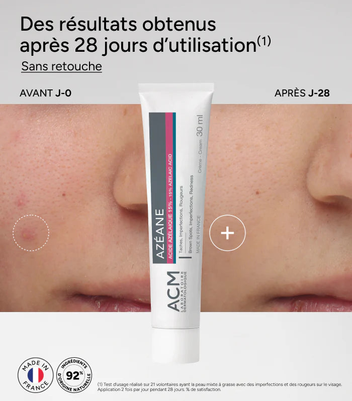 WAKEVA™ Crème 15% Acide Azélaïque