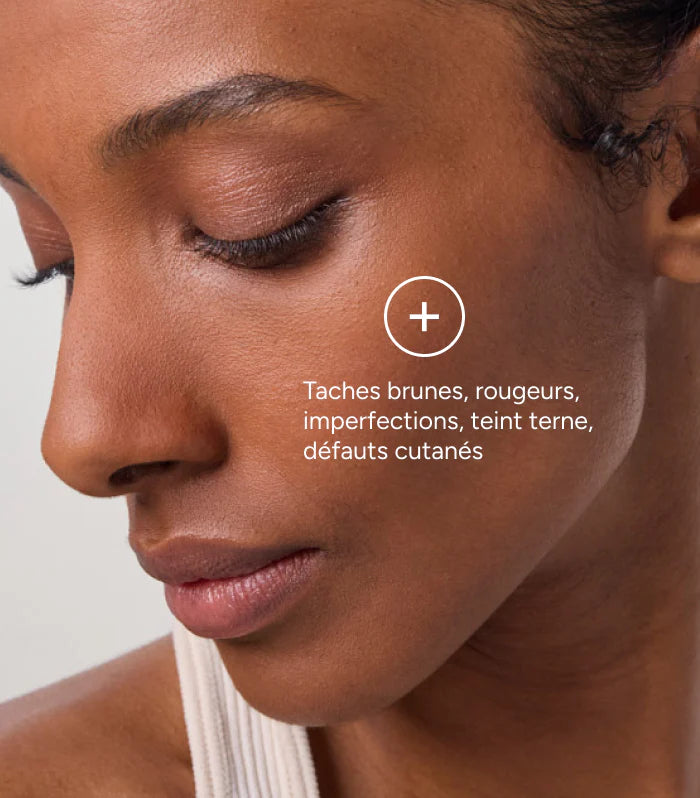 WAKEVA™ Crème 15% Acide Azélaïque